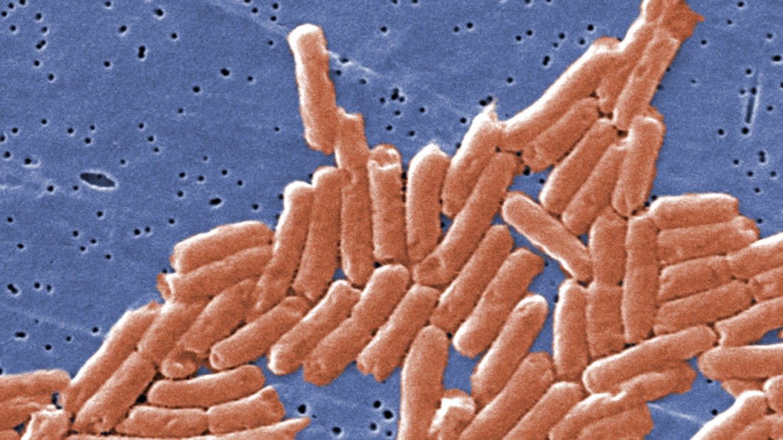 Diarrea, fiebre y cólicos son algunos síntomas de Salmonella.jpeg